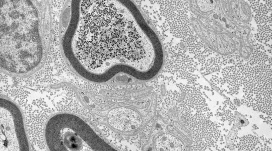 Transmission-electron-scanning-microscopy-TEM-SEM-camera