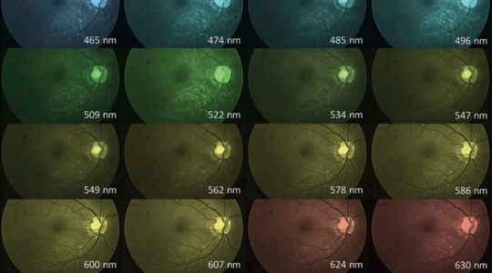 Ophthalmology-hyperspectral-applications