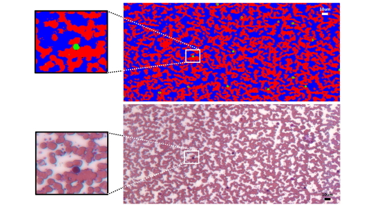 hyperspectral-imaging-microscopy-pathology