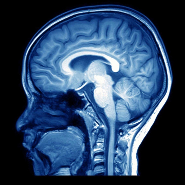 Medical-imaging-brain