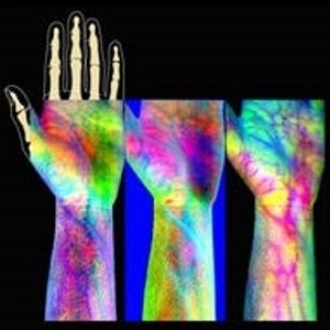 Medical-imaging-hyperspectral-hand